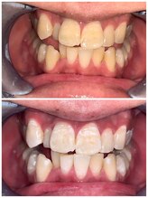 ライトビューティー 池袋店(LightBeauty)/症例写真