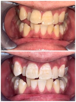 ライトビューティー 池袋店(LightBeauty)/症例写真