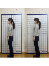 池川整骨院/姿勢矯正ビフォーアフター