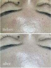 フェアリーヘア ニーナ(Fairy Hair Ni-na)/ハイドロジュエリーマスク