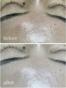 フェアリーヘア ニーナ(Fairy Hair Ni-na)/ハイドロジュエリーマスク