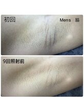 エヌアール(NR)/men's 脇