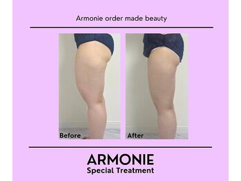 アルモニー(armonie)/何をしても痩せなかった方必見☆