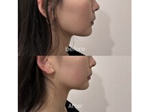 エウレカトーキョー(eureka.TOKYO)/女性国家資格者による小顔矯正