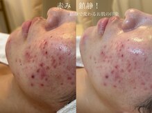 シェア(share.)/クリスティーナ　アンストレス