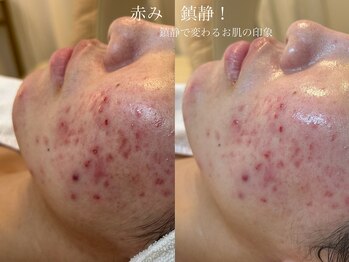 シェア(share.)/クリスティーナ　アンストレス