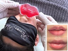 ノーブル(NOBLE)/ローマピンク大阪/黒ずみケア