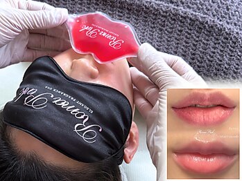 ノーブル(NOBLE)/ローマピンク大阪/黒ずみケア