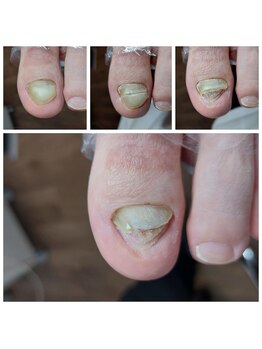 爪切り屋 足楽/