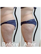 エミナル(EMINAL)/６０分のウィンバック効果　背面