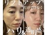 【韓国ツヤ肌管理No2】リフトUPも叶う韓方ピール×30%高濃度エクソソーム導入