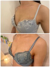 美人バスト 川崎店/バストアップ◇症例◇