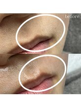 ルーム(room)/油断大敵！鼻下のおひげ