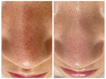 モーヴ 藤沢(MAUVE)/