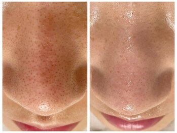 モーヴ 藤沢(MAUVE)/