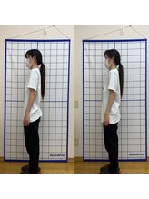 池川整骨院/姿勢矯正ビフォーアフター