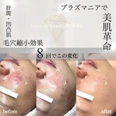 サロン ド ビューティージュエル(salon de beauty JEWEL)