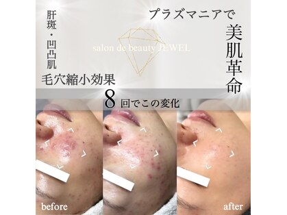 サロン ド ビューティージュエル(salon de beauty JEWEL)の写真