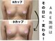 アーレ 博多本店(ARE)の写真