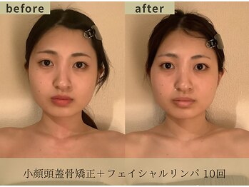 フェイシア 立川店(Facia)/before/after