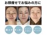 【頬コケ/窪み/老け見えでお悩みさんに】ふっくら立体お顔造形フェイシャル