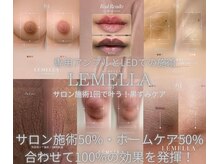 ソレラ(sorelle)