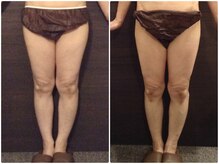 美容整体ウェリナ 名駅院/小顔矯正/骨盤矯正/美脚サロン 