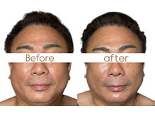 マヌレニ(manuleni)/男性こそ痛みのないケアが良い