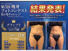 プリオール 高崎店(Prior)の雰囲気（2025年の痩身フォトコンテスト結果写真です。）