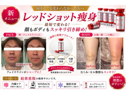 サロンドモモ(SALON de MOMO)の写真