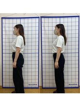 池川整骨院/姿勢矯正ビフォーアフター