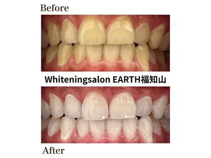 ホワイトニングサロン アース 福知山店(EARTH)の写真
