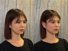 コガオ レンネ(Lenne)/小顔になるならこれ！