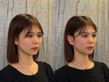 コガオ レンネ(Lenne)/小顔になるならこれ！