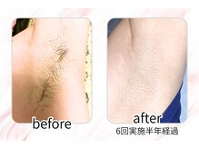 イチキュービー 仙台駅前東口店(19B)/わきの経過