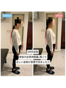 整体サロン　アンティオール　大森本店【頭痛/不眠/耳鳴り/腰痛/肩こり/骨盤矯正】/Before→After【姿勢改善】