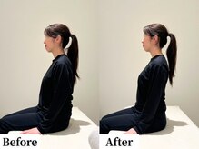 ソレア(Solea)/首肩こり・ストレートネック改善