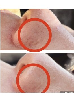 ファミリーセルフサロン 輪(Wa)/毛穴汚れ洗浄