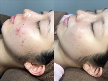 ソイズ 上中居店(SOIS)/V.O.Sサロンケア