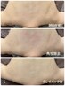 大人美背中ケア