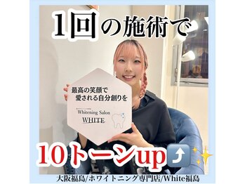 ホワイトニングサロン ホワイト(WHITE)/セルフホワイトニング/大阪/福島