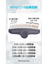 ホワイトニングショップ 横手店/ホワイトニング必要回数