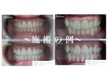 ファッシモ(fascimo)/before & after