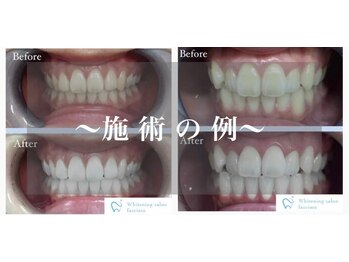 ファッシモ(fascimo)/before & after