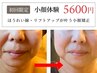 人数限定【エイジング☆小顔矯正】ヘッドスパ◆法令線/リフトアップ◆