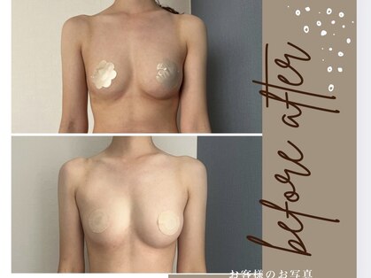 モア(moa)の写真