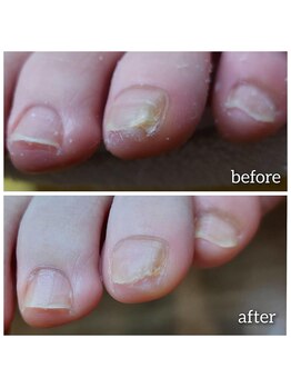 爪切り屋 足楽/