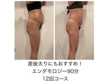 ミ ライト(m light)