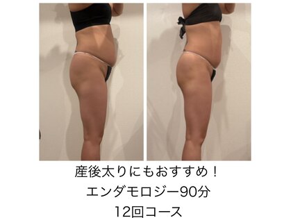 ミ ライト(m light)の写真