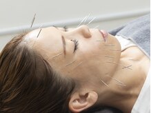 茂木整骨院 茂木鍼灸院の雰囲気（業界最高水準の美容鍼を提供しております。【美容鍼/小顔/整体】）